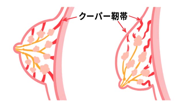 ワイヤレスブラで胸が垂れるのか