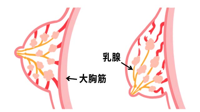 ノンワイヤーブラは胸が垂れる？